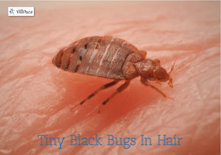 Tiny Black Bugs In Hair