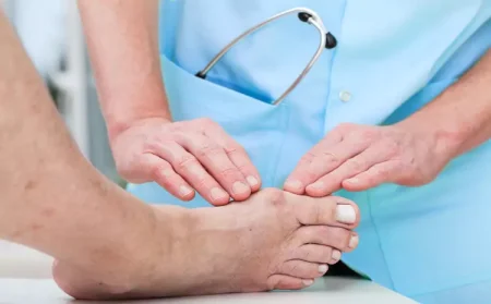 What to Expect During Cryosurgery for Morton’s Neuroma: A Patient’s Guide
