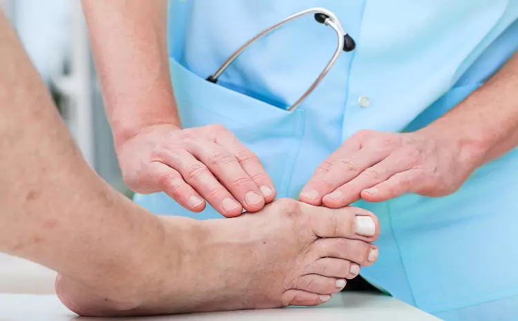 What to Expect During Cryosurgery for Morton’s Neuroma: A Patient’s Guide