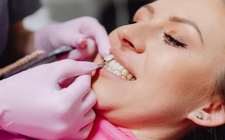 The Pros and Cons of Different Types of Veneers: Which One is Right for You?